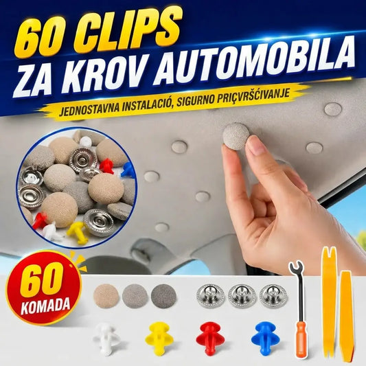 🔥【60 komada】🚗Kopče za skidanje platna s krova automobila, uključujući alate za ugradnju, olakšavaju uklanjanje i sastavljanje.