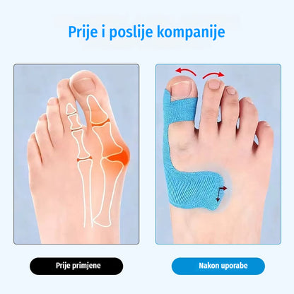 [50/100 komada] Elastični zavoji za prste, zavoji za opekline, izdržljivi sportski zavoji